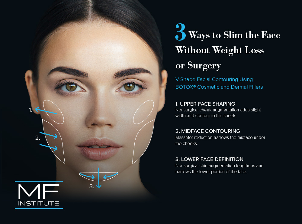 Forget Buccal Fat Removal: Start With Botox® For Face Slimming (Updated  2023) | Mabrie Facial Institute
